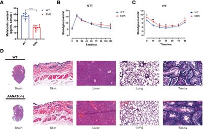 Gut Microbiota Dysbiosis Induced by Decreasing Endogenous Melatonin Mediates the Pathogenesis of Alzheimer’s Disease and Obesity